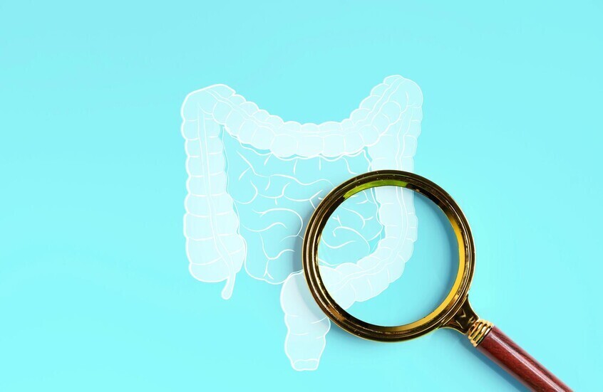 جفرا نيوز : اكتشاف علاقة بين أدوية الكوليسترول وسرطان القولون